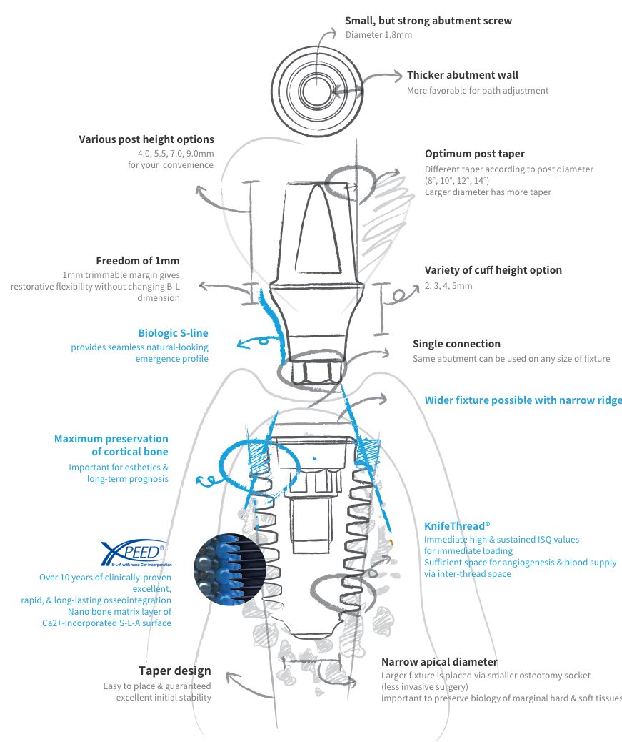 Biological Design of AnyRidge Implants