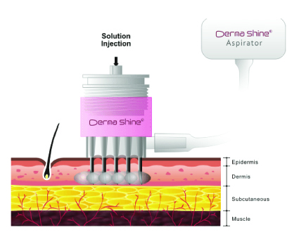 Dermashine Pro Treatment Mechanism