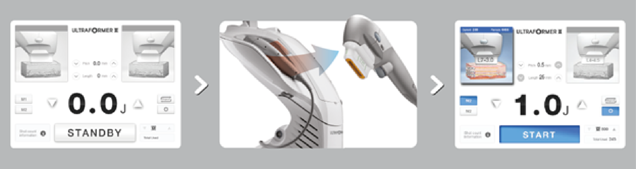 Automatic Handpiece Recognition