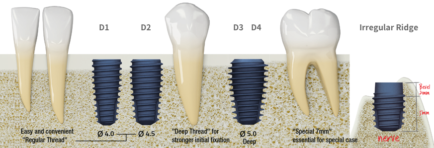 Variety of Fixture Design